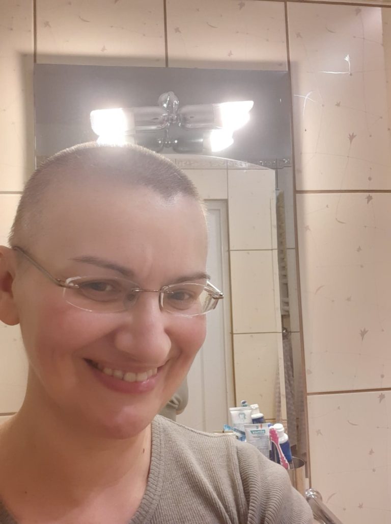SKUTKI CHEMIOTERAPII  →  UTRATA WŁOSÓW